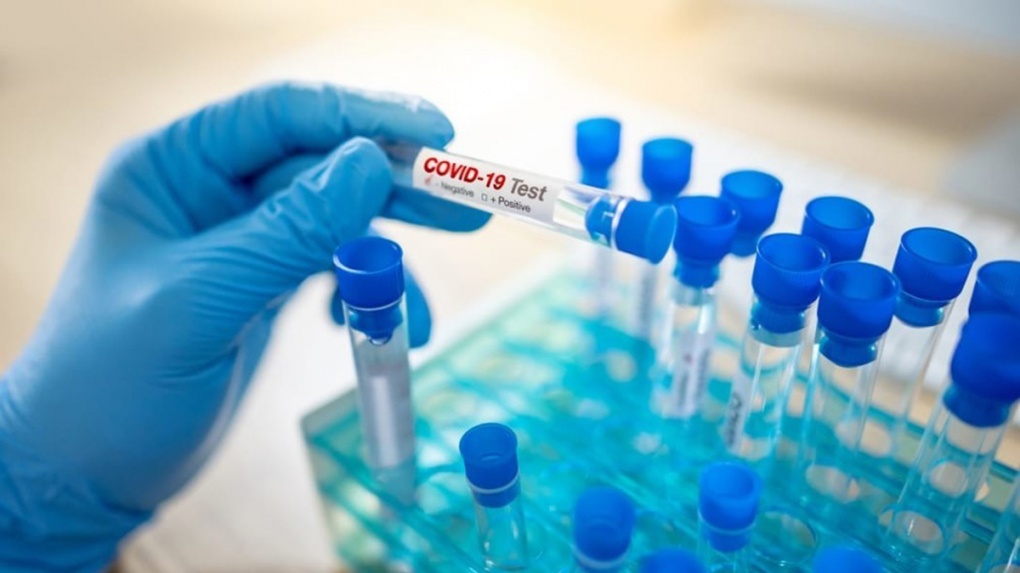 В Тамбовской области растет число заболевших вирусом COVID-19