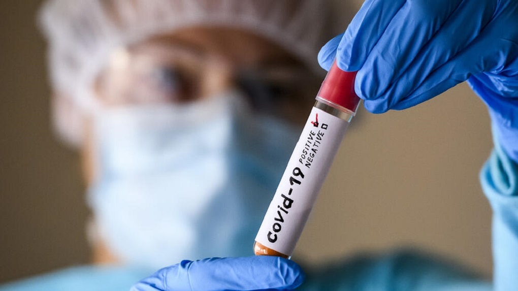 В Тамбовской области зарегистрировали 14 новых случаев заболевания коронавирусной инфекцией